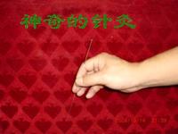 针灸